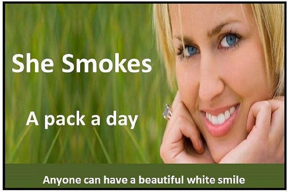 Teeth Whitening Postcard